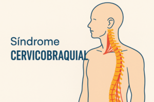 Síndrome Cervicobraquial. Causas